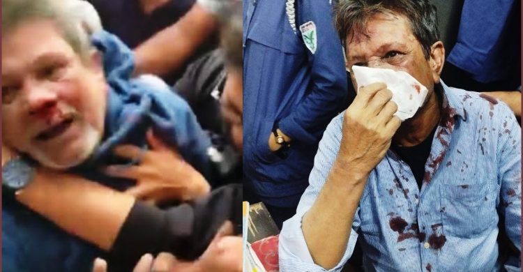 সিলেটের আদালতে আ’লীগ নেতা নুরুকে লাথি-ঘুসিতে রক্তাক্ত জখম