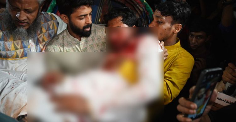 মাথা, নাক ও চোয়ালের হাড় ভেঙে গেছে নুরের, বৈঠকে বসছে মেডিকেল বোর্ড